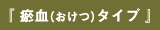 『 瘀血（おけつ）タイプ 』