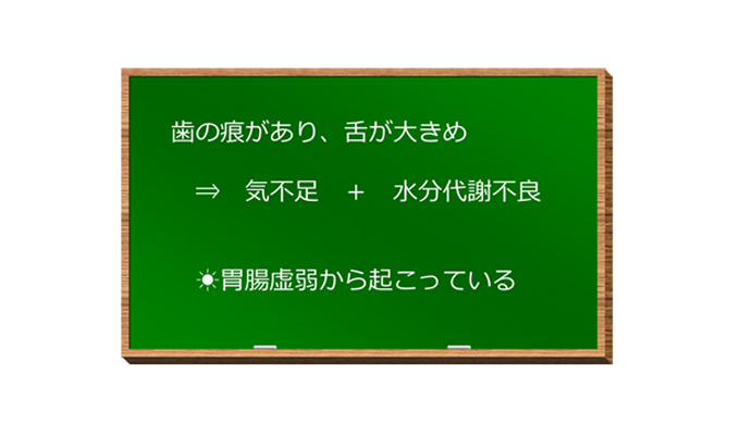 舌に歯の痕がついている ときの原因 養生 漢方ライフ 漢方を始めると 暮らしが変わる