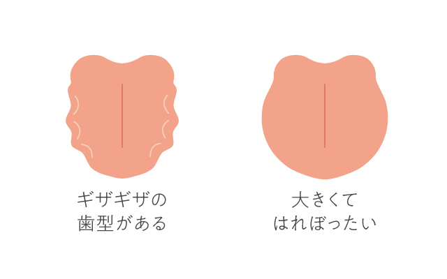 雨の日に体調が悪いのはむくみのサイン 漢方ライフ 漢方を始めると 暮らしが変わる